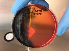 Cepa Listeria monocytogenes en agar PALCAM